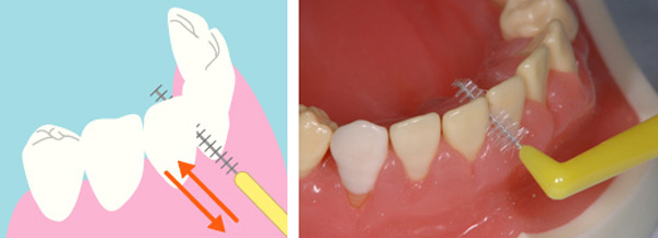 歯と歯の間は、歯間ブラシを使用する。