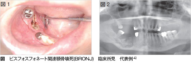 歯医者さんに伝えていただきたい病気と薬 歯とお口のことなら何でもわかる テーマパーク8020
