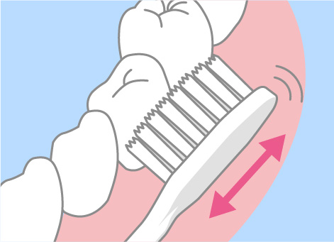 歯を1〜2本ずつみがく