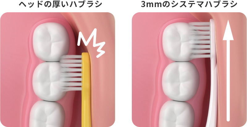 ヘッドの薄いシステマ歯ブラシは奥歯の奥まで届きやすい