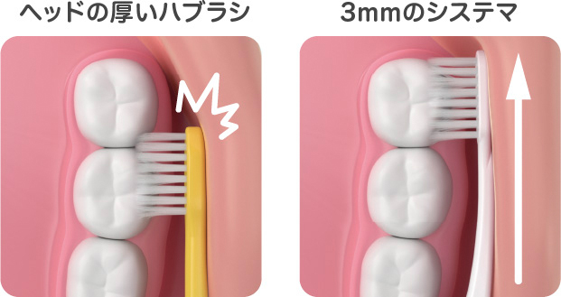 ヘッドの薄いシステマ歯ブラシは奥歯の奥まで届きやすい
