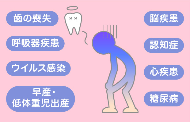 歯周病の原因菌はさまざまな全身の病気に影響するといわれています
