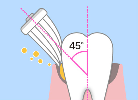 ハブラシの毛先を45度でみがく