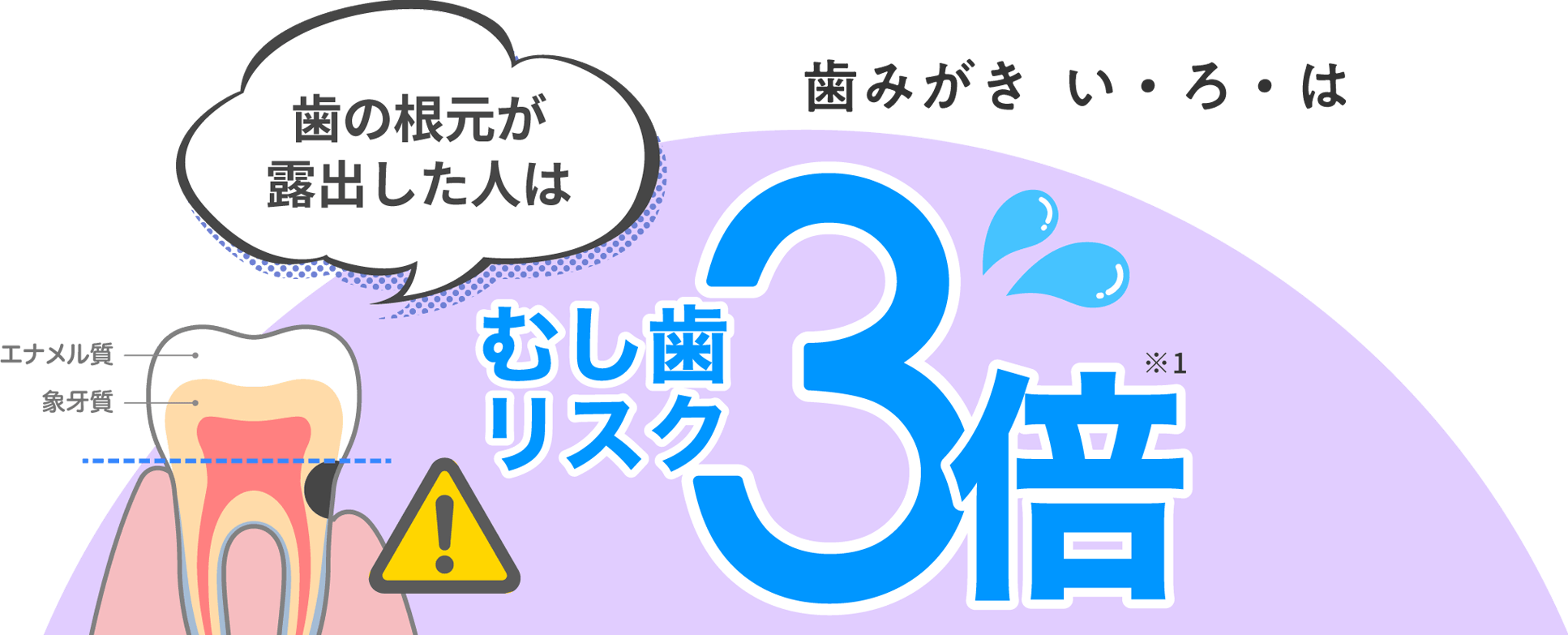 歯みがき  い・ろ・は　“歯の根元が露出した人はむし歯リスク3倍”