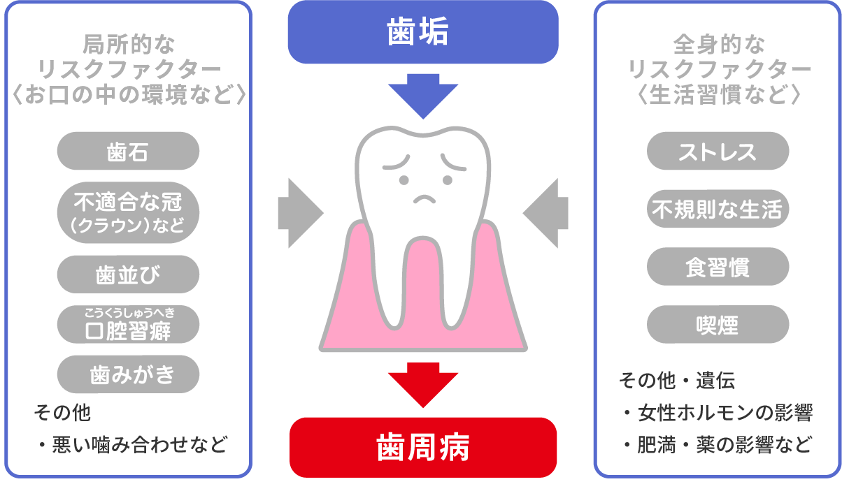 デンタルフロスを併用することで歯垢除去率は86%に上昇する