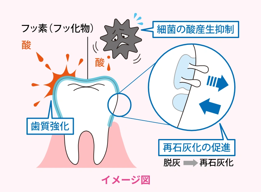 フッ素の働きのイメージ図