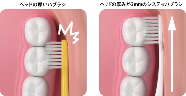 ヘッドの厚いハブラシ ヘッドの厚みが3mmのシステマハブラシ 比較図