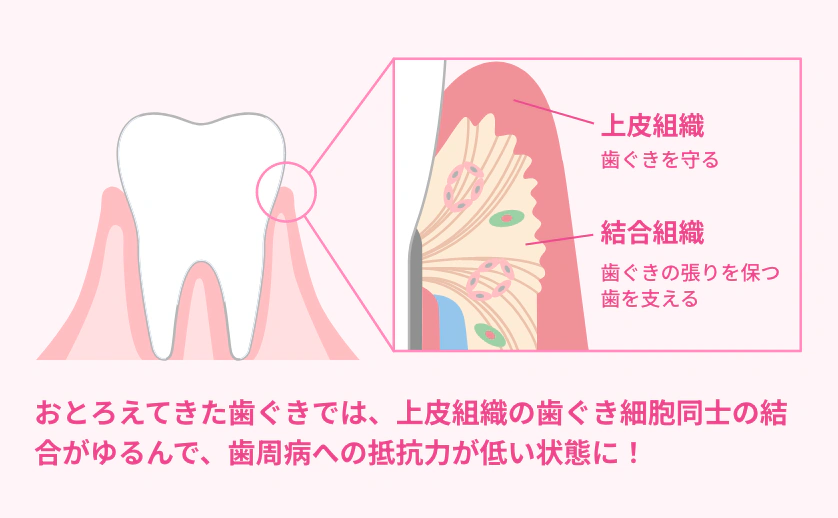 おとろえてきた歯ぐきでは、上皮組織の歯ぐき細胞同士の結合がゆるんで、歯周病への抵抗力が低い状態に！