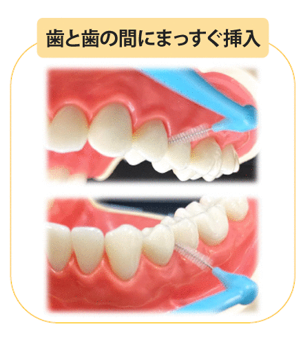 -Message -日本歯科医師会は「8020運動」に『オーラルフレイル』という新たな概念を加え、健康寿命をサポートしてまいります。