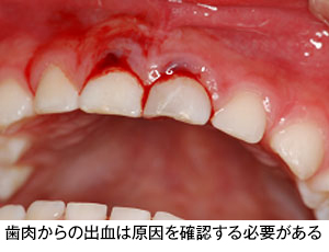 歯の外傷 歯とお口のことなら何でもわかる テーマパーク80