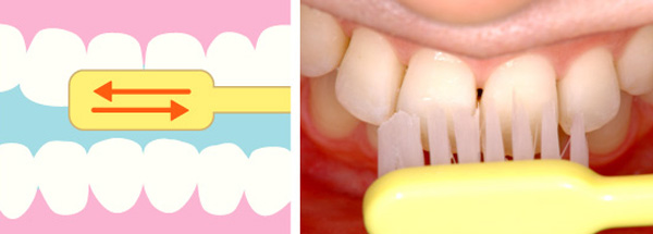 歯の表と裏側に歯ブラシの毛先を直角に当て往復運動する。