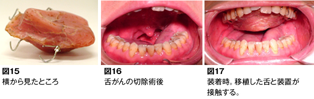 言語機能と構音障害 - 歯とお口のことなら何でもわかる テーマ