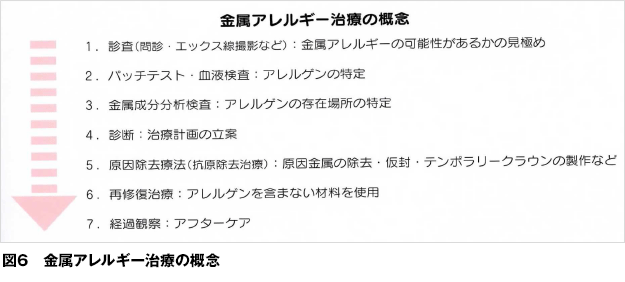 金属アレルギー 歯とお口のことなら何でもわかる テーマパーク80