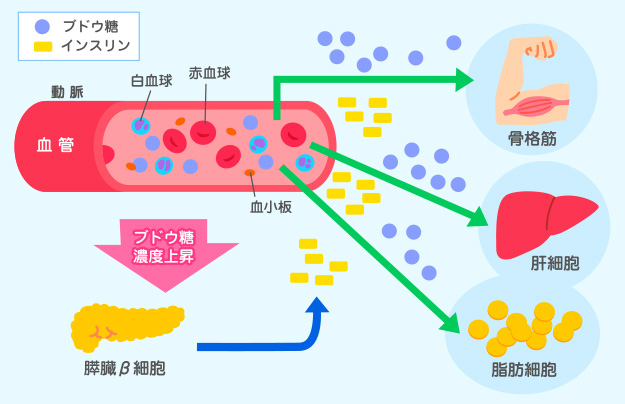 糖尿病ってどんな病気？｜歯周病と糖尿病 - 歯とお口のことなら何でもわかる テーマパーク8020