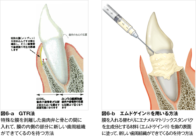 歯周病 歯とお口のことなら何でもわかる テーマパーク80