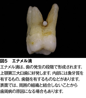 歯の形 数 色 歯肉の色の異常 歯とお口のことなら何でもわかる テーマパーク80