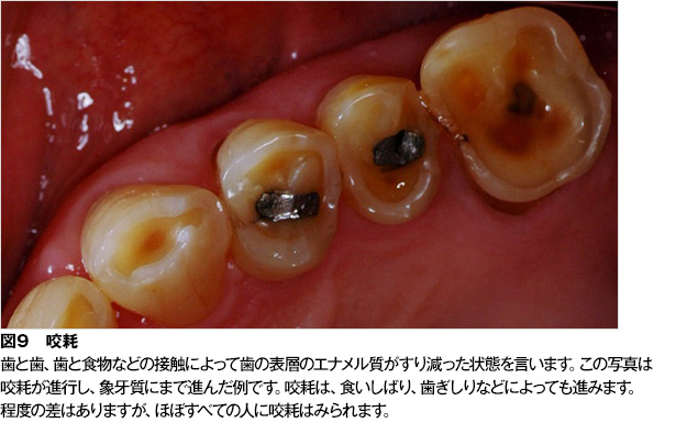 歯の形 数 色 歯肉の色の異常 歯とお口のことなら何でもわかる テーマパーク80