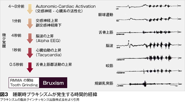 歯ぎしり 歯とお口のことなら何でもわかる テーマパーク80