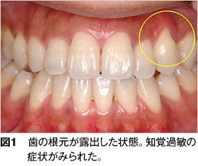 治し 方 過敏 知覚