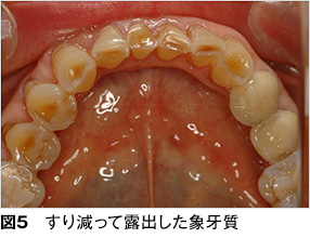 過敏 治療 知覚