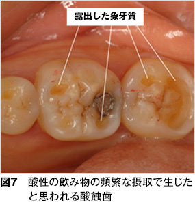 過敏 治療 知覚