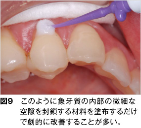 治し 方 過敏 知覚