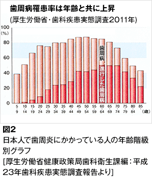 歯周病 歯とお口のことなら何でもわかる テーマパーク80