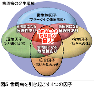 糖尿病と歯周病 スパイラル