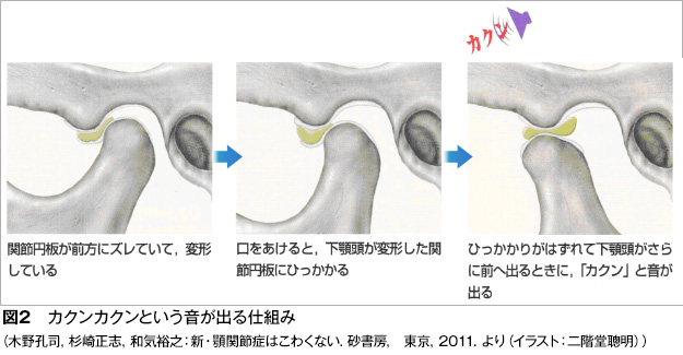 方 治し 症 額 痛 関節