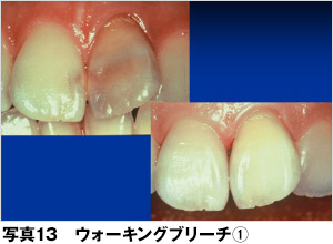 ホワイトニング 歯とお口のことなら何でもわかる テーマパーク80