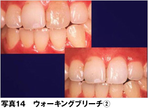 ホワイトニング 歯とお口のことなら何でもわかる テーマパーク80