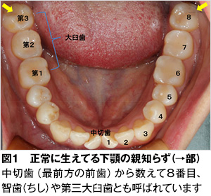 親知らず 歯とお口のことなら何でもわかる テーマパーク80