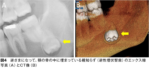 親知らず 歯とお口のことなら何でもわかる テーマパーク80