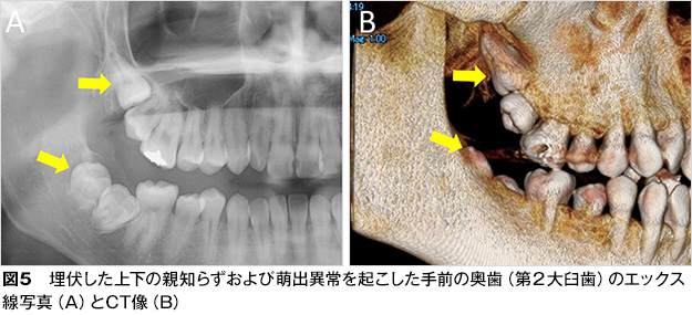 親知らず 歯とお口のことなら何でもわかる テーマパーク80