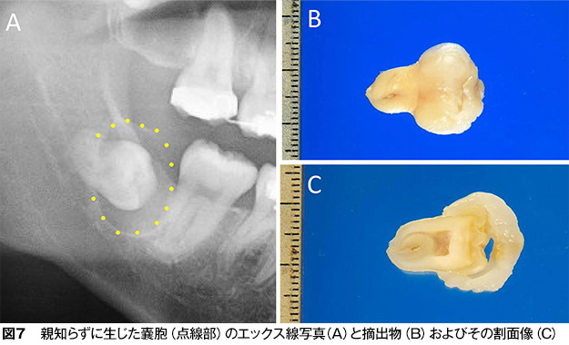 親知らず 歯とお口のことなら何でもわかる テーマパーク80