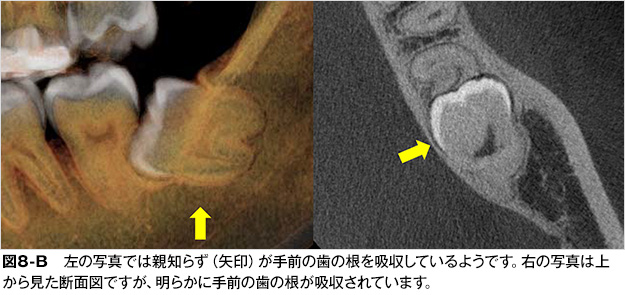 親知らず 歯とお口のことなら何でもわかる テーマパーク80