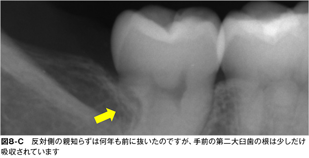 親知らず 歯とお口のことなら何でもわかる テーマパーク80