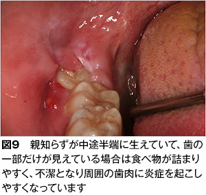 親知らず 歯とお口のことなら何でもわかる テーマパーク80