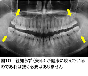 親知らず 歯とお口のことなら何でもわかる テーマパーク80