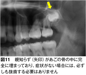 親知らず 歯とお口のことなら何でもわかる テーマパーク80